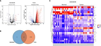 Identification and Validation of TYMS as a Potential Biomarker for Risk of Metastasis Development in Hepatocellular Carcinoma